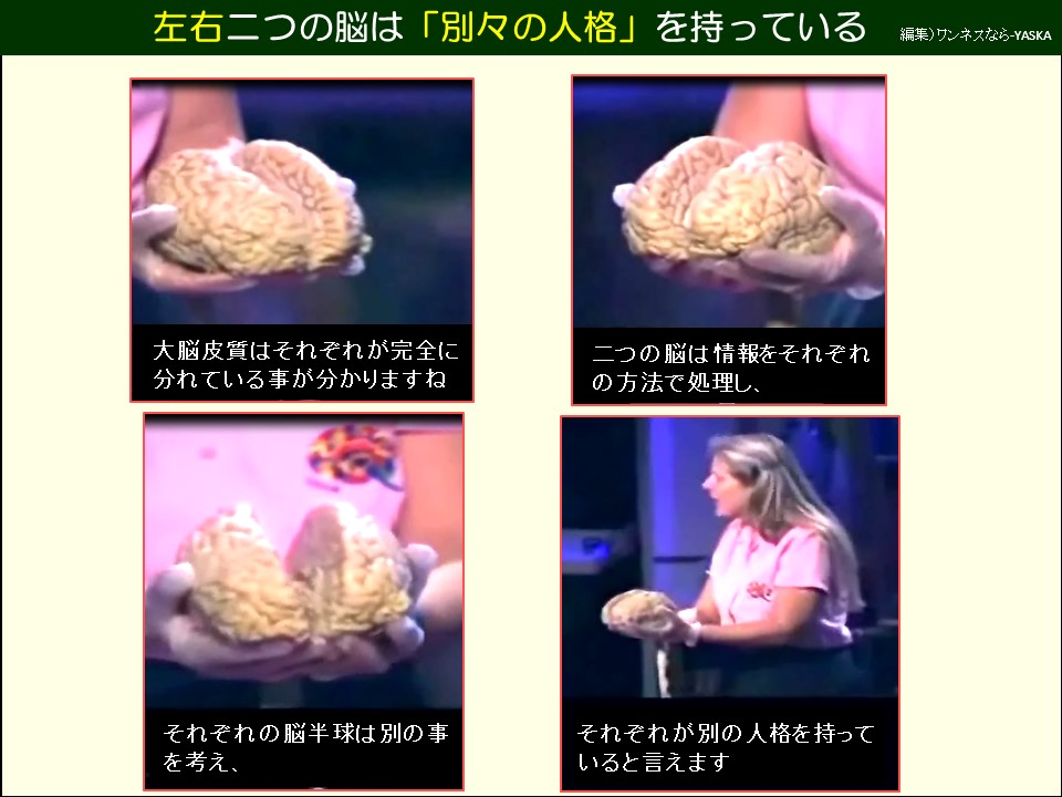 左右二つの脳は「別々の人格」を持っている

大脳皮質はそれぞれが完全に分れている事が分かりますね

二つの脳は情報をそれぞれの方法で処理し、

それぞれの脳半球は別の事を考え、

それぞれが別の人格を持っていると言えます