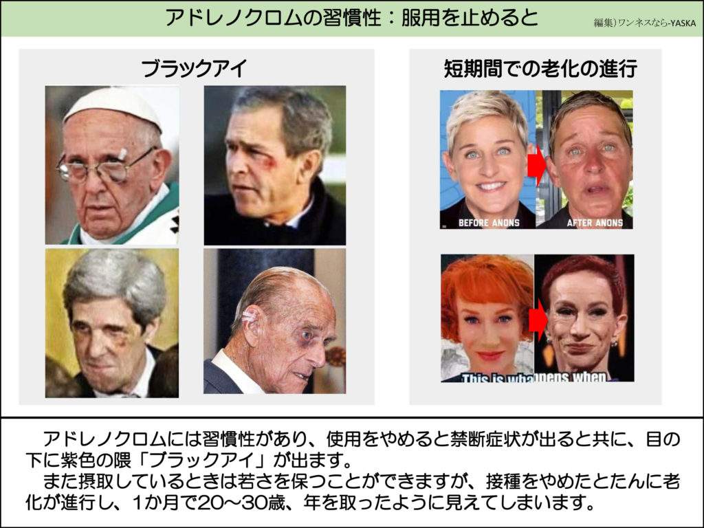 アドレノクロムの習慣性:服用を止めると

ブラックアイ

短期間での老化の進行

アノンズ前

アノンズ後

これはウィハンネンズ

アドレノクロムには習慣性があり、使用をやめると禁断症状が出ると共に、目の下に紫色の隈「ブラックアイ」が出ます。

また摂取しているときは若さを保つことができますが、接種をやめたとたんに老化が進行し、1か月で20~30歳、年を取ったように見えてしまいます。