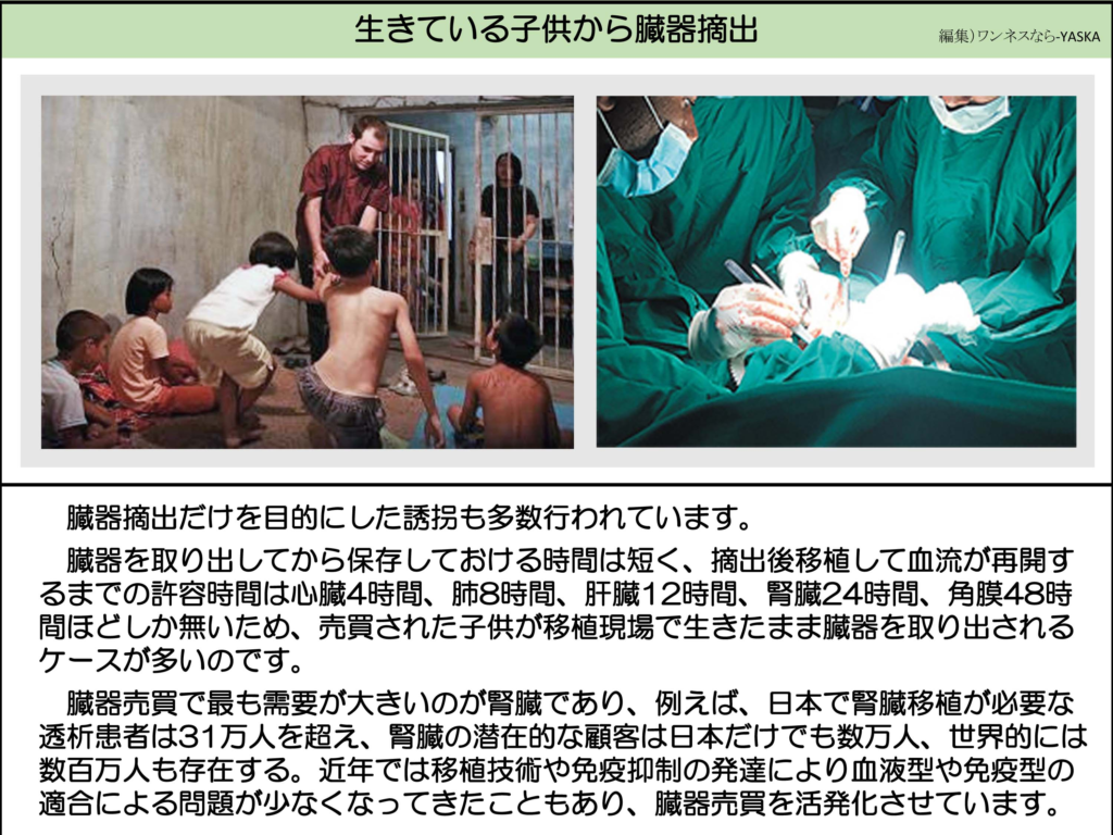 生きている子供から臓器摘出

臓器摘出だけを目的にした誘拐も多数行われています。

臓器を取り出してから保存しておける時間は短く、摘出後移植して血流が再開するまでの許容時間は心臓4時間、肺8時間、肝臓12時間、腎臓24時間、角膜48時間ほどしか無いため、売買された子供が移植現場で生きたまま臓器を取り出されるケースが多いのです。

臓器売買で最も需要が大きいのが腎臓であり、例えば、日本で腎臓移植が必要な透析患者は31万人を超え、腎臓の潜在的な顧客は日本だけでも数万人、世界的には数百万人も存在する。近年では移植技術や免疫抑制の発達により血液型や免疫型の適合による問題が少なくなってきたこともあり、臓器売買を活発化させています。